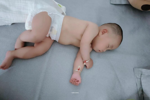 琼中六个月宝宝眼睛散光